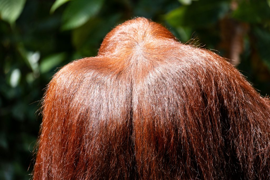 A Complete Guide to Graft Requirements for Natural Hair Transplants