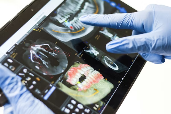 Things to Know Before Getting Dental Implants in Hyderabad
