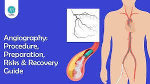 Coronary Angiogram: Procedure, Preparation, Risks and Recovery