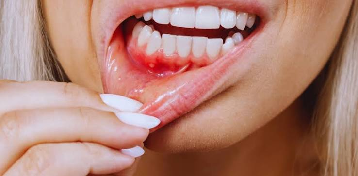 How Gum Disease Affects South Shore MA Adults