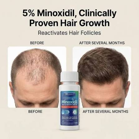 Clinically Proven Topical Solutions for Stimulating Hair Follicles